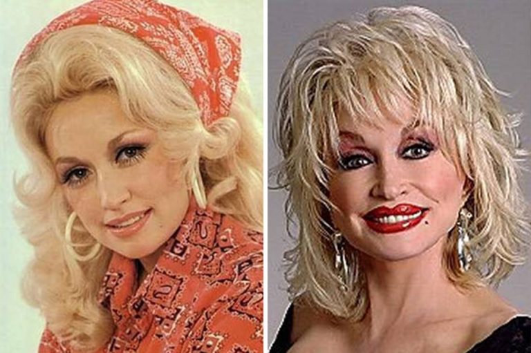 Dolly Parton’s Plastic Surgery, The Many Procedures She Had Done ...